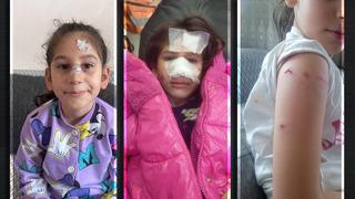 İstanbul'da sahipli köpek dehşeti! Okul bahçesine daldı, 5 öğrenci ve bir öğretmeni ısırdı