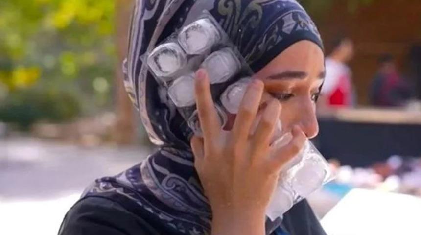 Beyza'ya yüzünün yanık halini göstermemişler! Aylar sonra yüzünün yanmış halini uyararak paylaştı