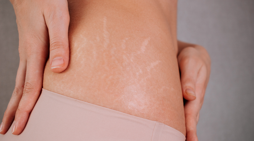 “Keşke daha önce bilseydim” demeyin! Çatlak oluşumunu önlemek için dikkat etmeniz gerekenler