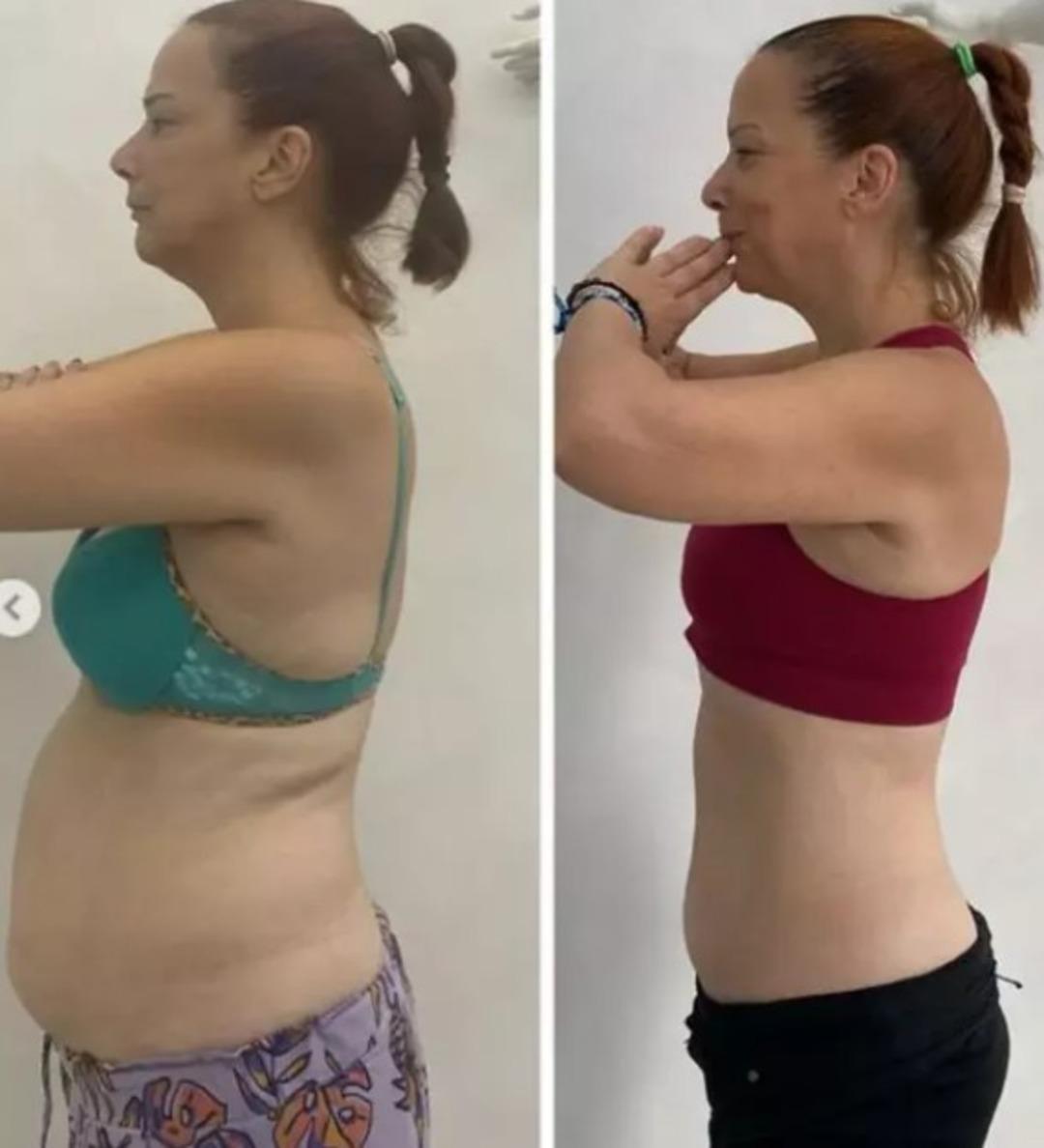 1,5 ayda 10 kilo vermişti! Yarım Elma’nın Yonca’sı Janset Paçal yeni imajıyla beğeni topladı 2