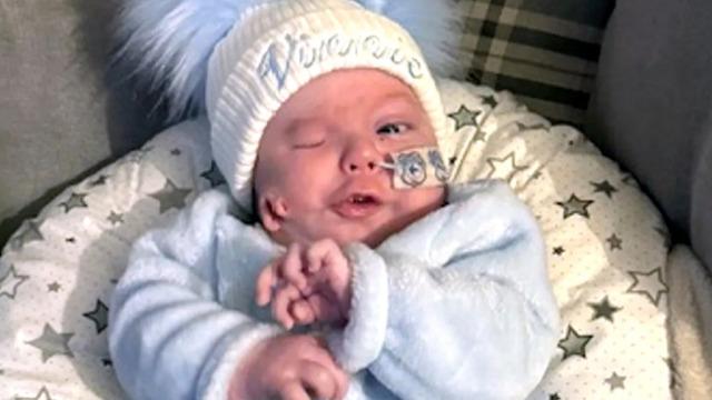 Çok nadir görülse de yaşandı... Yeni doğan bebek yanağında kulakla dünyaya geldi! 