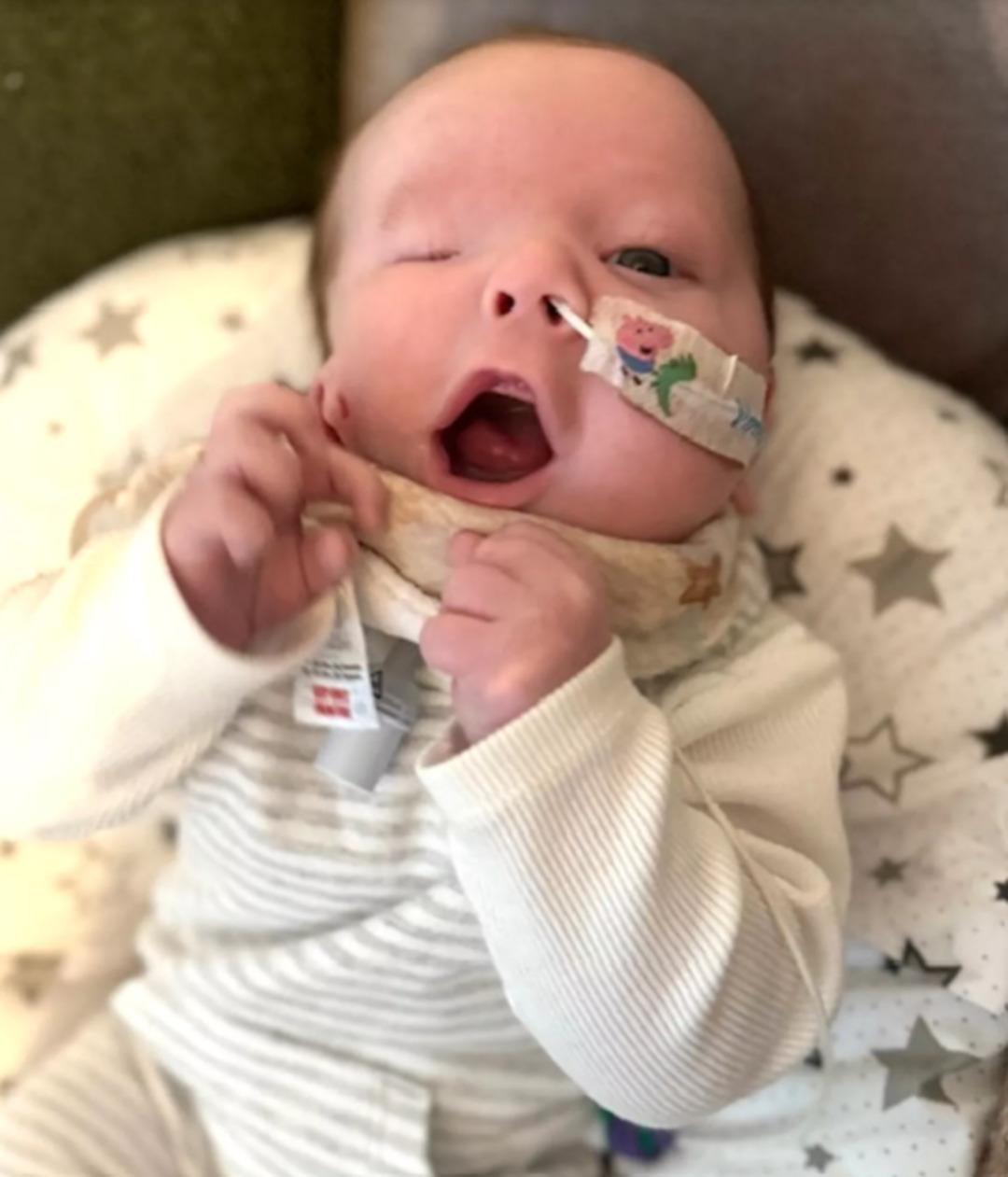 Çok nadir görülse de yaşandı... Yeni doğan bebek yanağında kulakla dünyaya geldi!  2