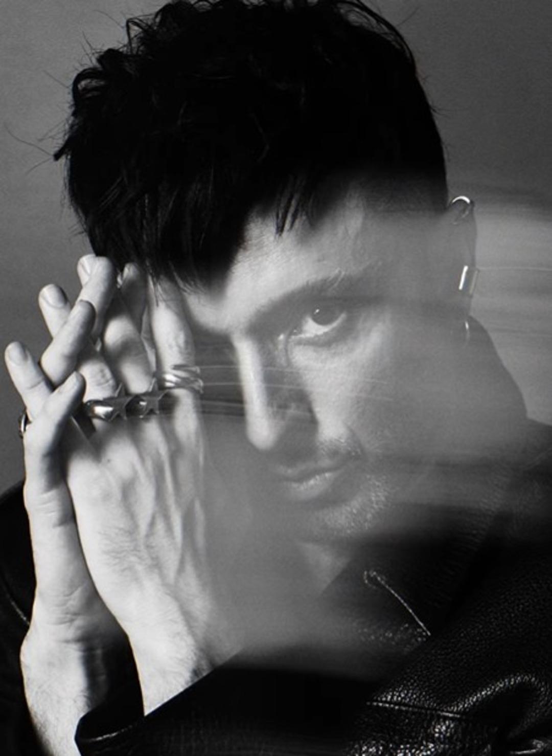 Saç estetiği yaptırmıştı! Mabel Matiz in yeni imajı sosyal medyayı ikiye böldü  2