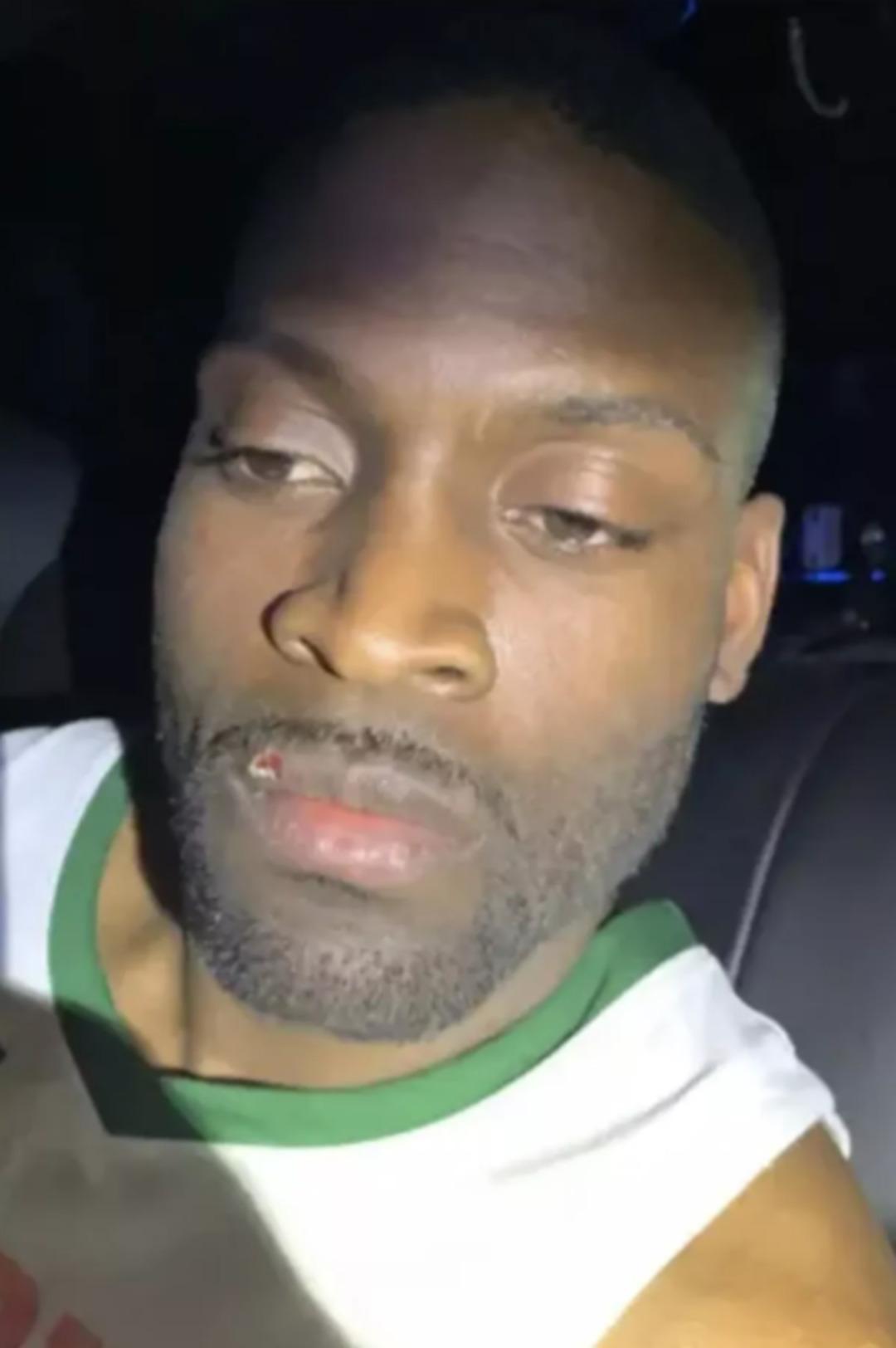 Polisin gözü önünde servet yuttu! 770 bin dolarlık küpeler röntgenle görüntülendi... 2