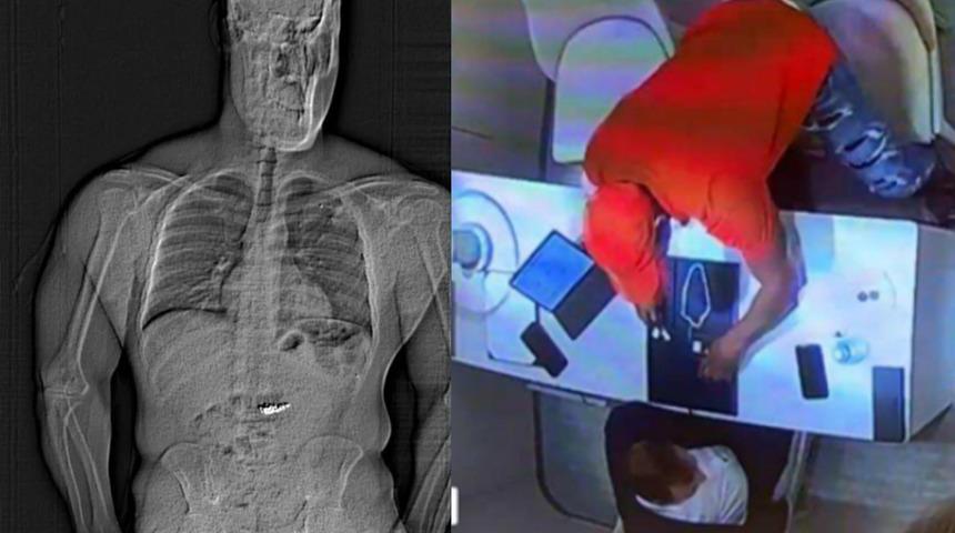 Polisin gözü önünde servet yuttu! 770 bin dolarlık küpeler röntgenle görüntülendi...