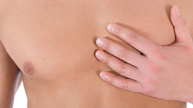 Erkeklerde meme büyümesi: Jinekomasti sorunu çığ gibi artıyor…