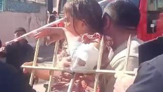 Kolu korkuluğa saplanan 7 yaşındaki çocuk yaralandı