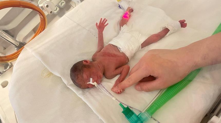 Parmak bebek yoğun bakımda büyüdü: 400 gram doğan Aylin bebek hayata tutundu!