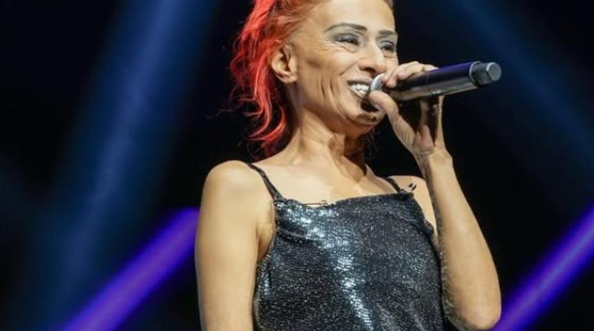 Saç boyası yüzünü yakmıştı! Yıldız Tilbe son durumunu açıkladı  