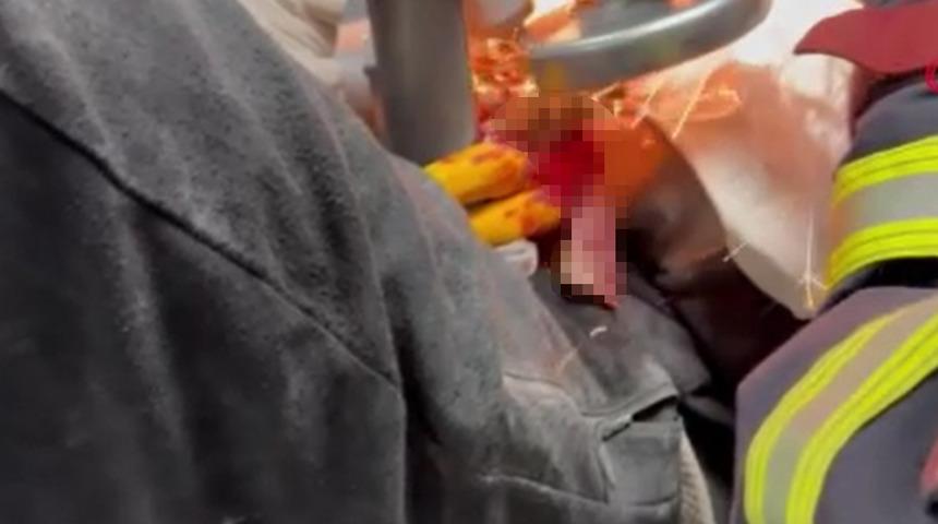 Mersin'de facianın eşiğinden dönüldü! Parmağının sıkıştığı iş makinesinin parçasıyla hastaneye kaldırıldı