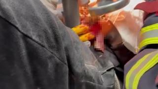 Mersin'de facianın eşiğinden dönüldü! Parmağının sıkıştığı iş makinesinin parçasıyla hastaneye kaldırıldı