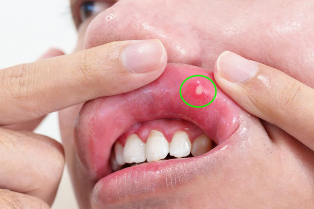 iStock-1566407095