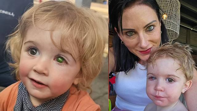 Akrabası yüzünden gözünü kaybetti! Bir öpücük korneasında 4 mm'lik delik açtı... Küçük çocuk virüse yenildi