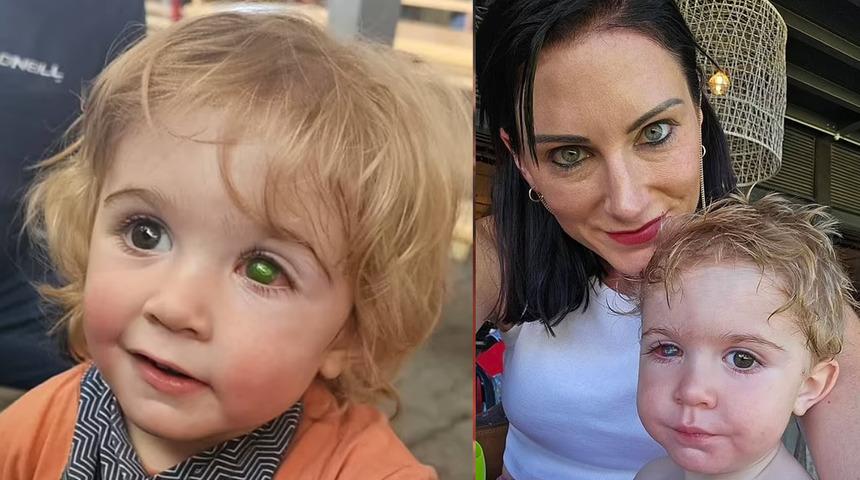 Akrabası yüzünden gözünü kaybetti! Bir öpücük korneasında 4 mm'lik delik açtı... Küçük çocuk virüse yenildi