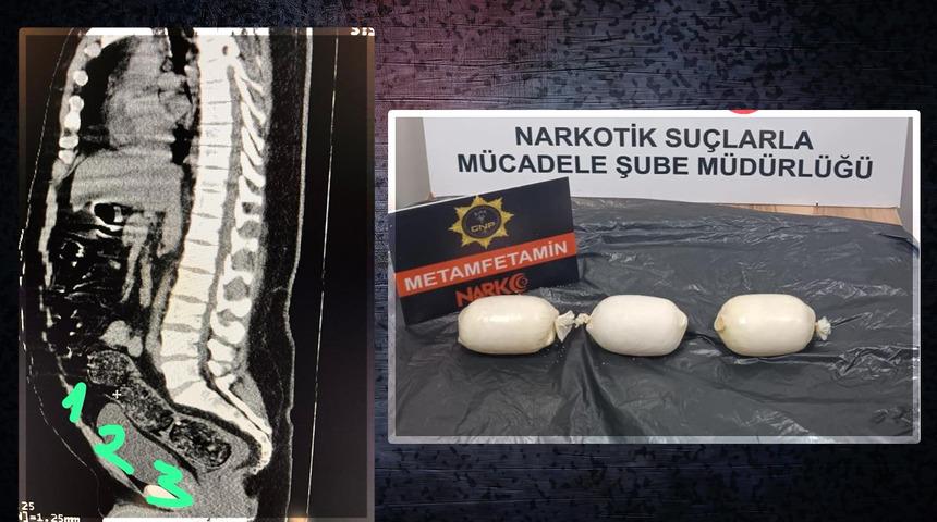 Zulası bağırsaklarında çıktı... Tam 3 kapsül sığdırmış! Miktarı hayret ettirdi