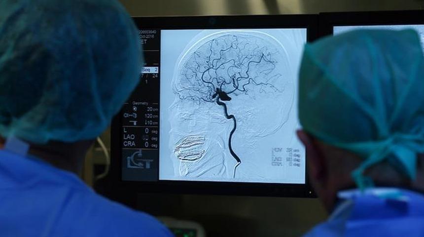 Beyin pili geleceğin tedavisi… Epilepsi’den alzheimer’a umut Işığı: “Otizm gibi hastalıklarda da kullanılabileceğini göstermektedir” 