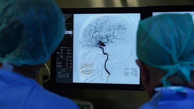 Beyin pili geleceğin tedavisi… Epilepsi’den alzheimer’a umut Işığı: “Otizm gibi hastalıklarda da kullanılabileceğini göstermektedir” 