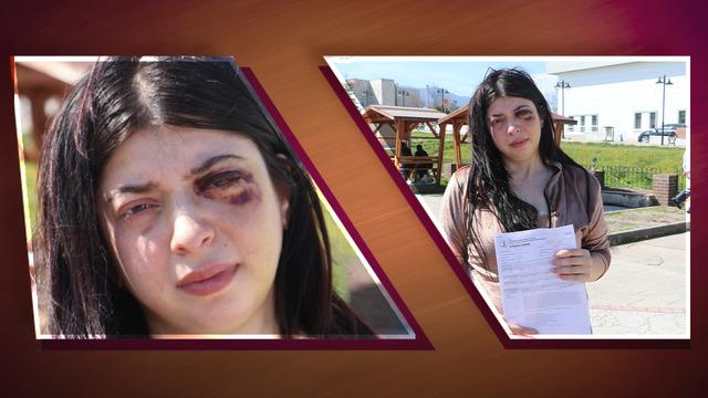 Samsun'da iğrenç olay! 'Ücretin ne kadar? Etek giyiyorsan böylesin' diyerek saldırdı: 3 ay sıvıyla besleneceğim