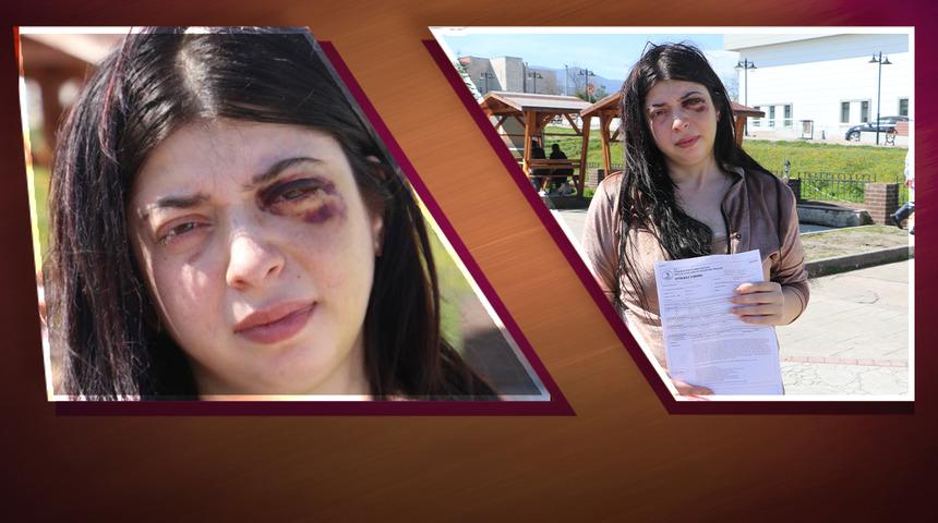 Samsun'da iğrenç olay! 'Ücretin ne kadar? Etek giyiyorsan böylesin' diyerek saldırdı: "3 ay sıvıyla besleneceğim"