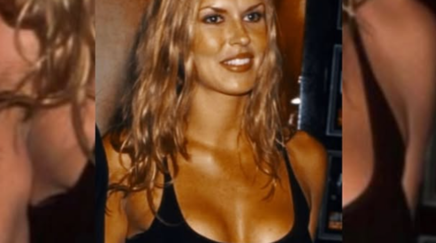 Bir zamanların ünlü modeliydi! Brandi Glanville yüzünün eridiğini söyledi! Suratında mantar ve parazit oluştu! İşte son hali...