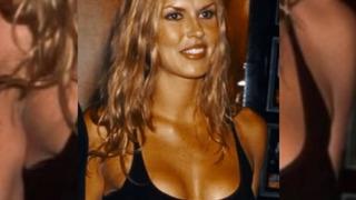 Bir zamanların ünlü modeliydi! Brandi Glanville yüzünün eridiğini söyledi! Suratında mantar ve parazit oluştu! İşte son hali...