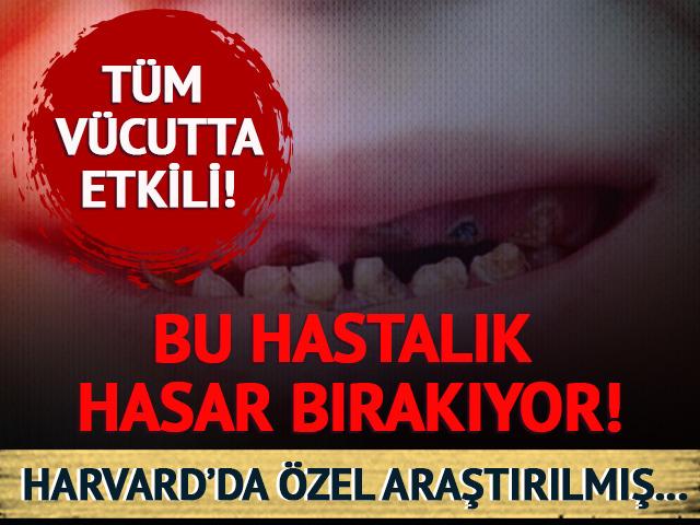 Dişlerinde çürük mü var? O hastalığa dikkat!