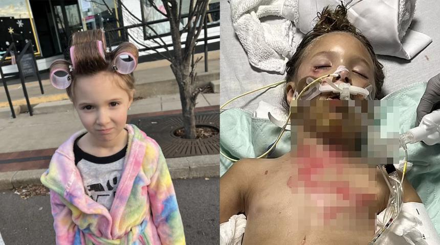 Sosyal medyada gördüğü deney felaketi oldu! Mikrodalgaya attığı oyuncak suratına patladı...