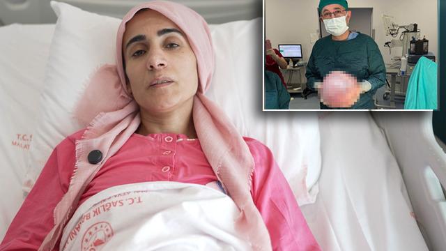 Kilo aldığını sandı, ağrıları artınca gerçek ortaya çıktı! Tam 7 kilogram ağırlığında