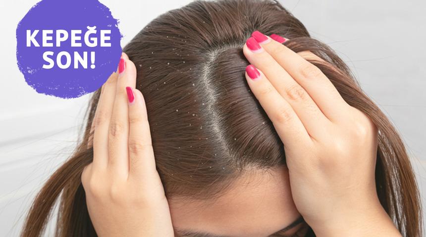 Aloe vera ile kepekten kurtulun: Evde doğal maske tarifi