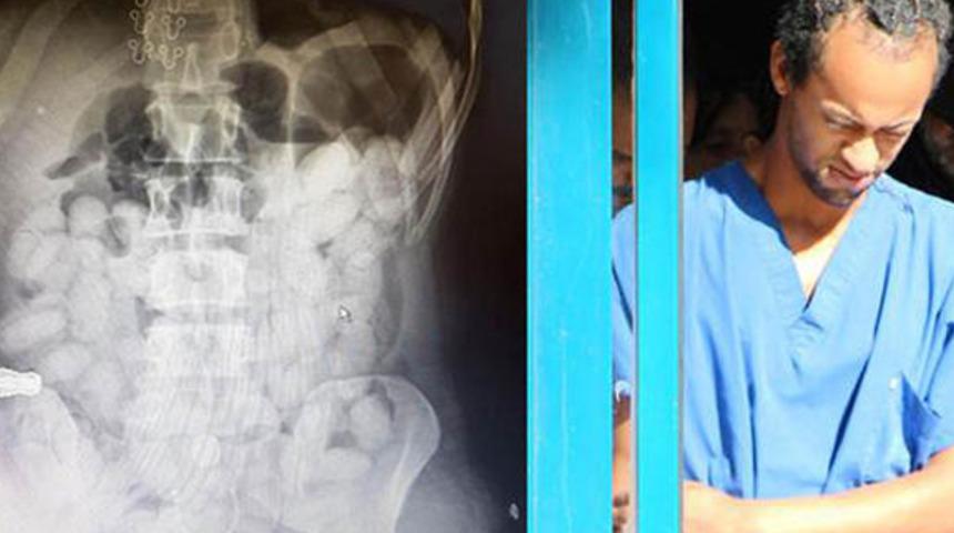 Midesinde uyuşturucu taşımaya 25 yıl yedi