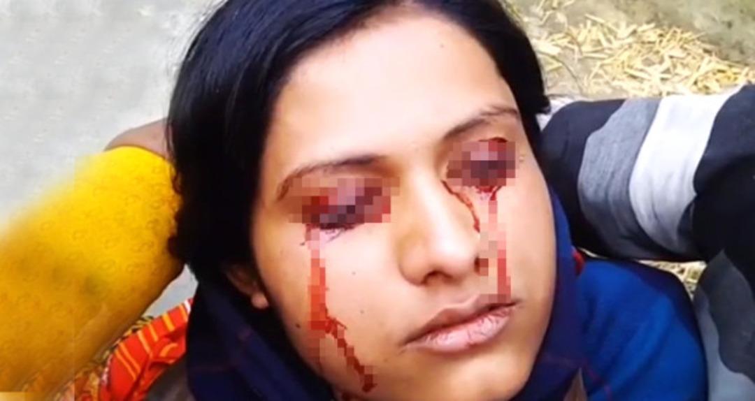 Kan terleyen karısını cadı diye terk etti!