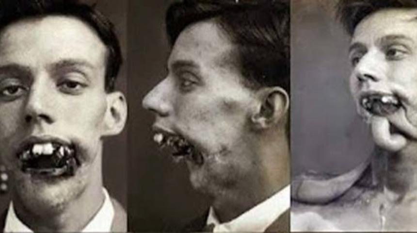 Plastik cerrahinin ortaya çıkış öyküsü şaşırtıyor