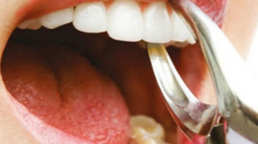 Tedavi edilmez ise kemiği eritiyor!