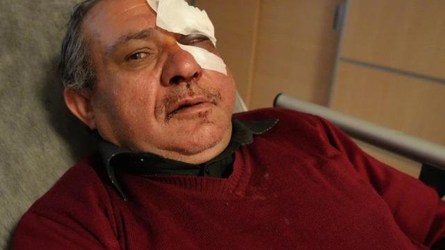 Doktoru darbeden 2 şahıs, adli kontrolle serbest