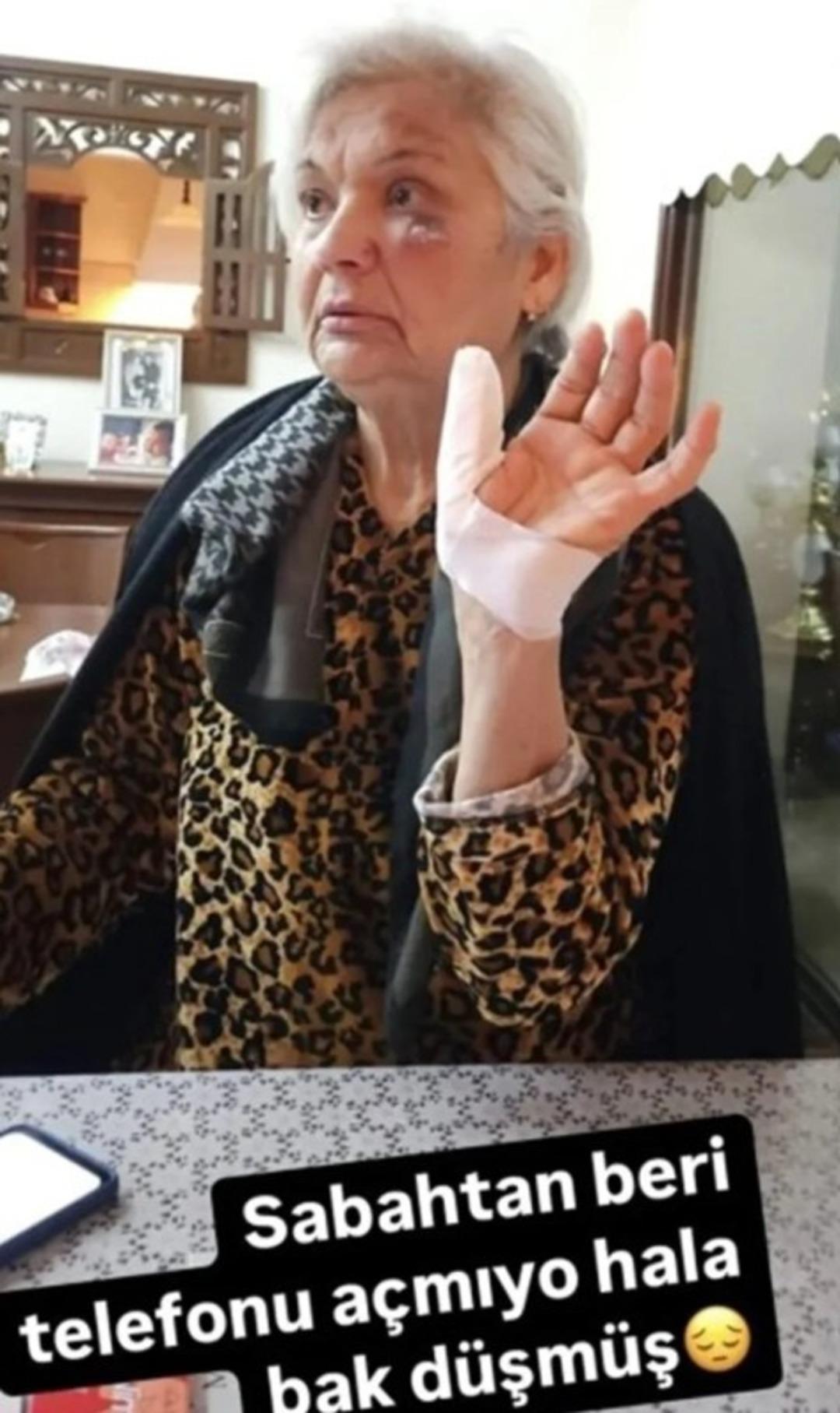 annesi 1