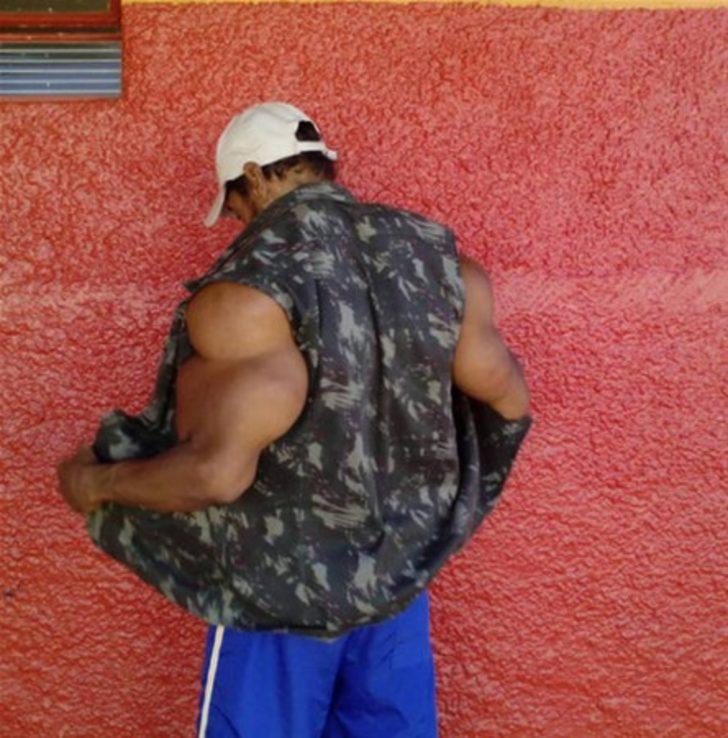 Synthol Man Dies