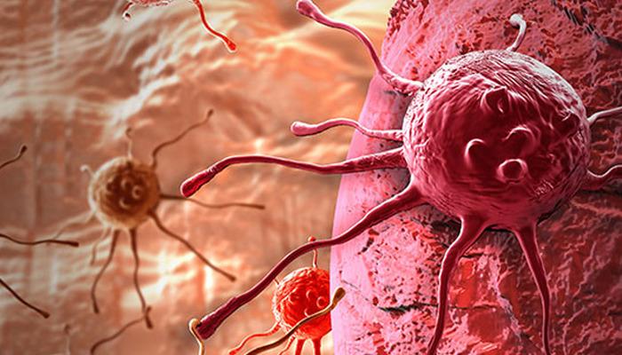 Bu kanser türlerine geliştirilmiş tarama testleri yapılıyor: Erken teşhis mümkün! Uzmandan çarpıcı açıklamalar...