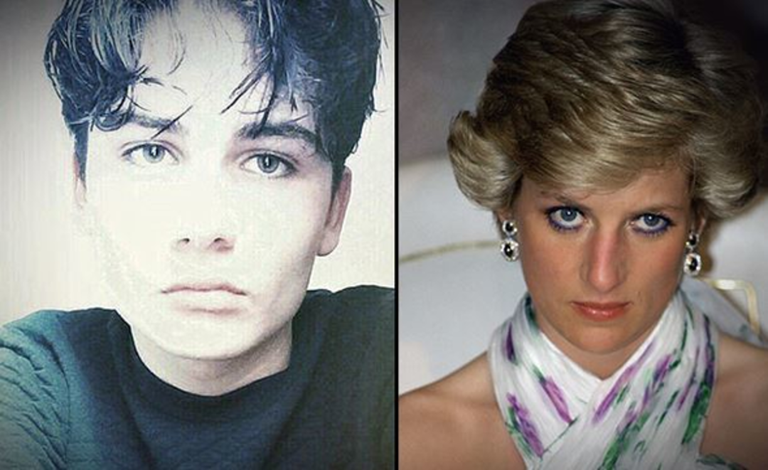 Tek hayali Diana'ya benzemekti! İşte son hali