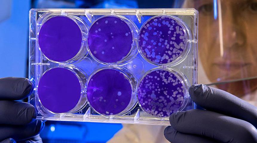 Ünlü aktörün eşini hayattan koparmıştı: O virüs 3 can daha aldı! Hava yoluyla bulaşabiliyor