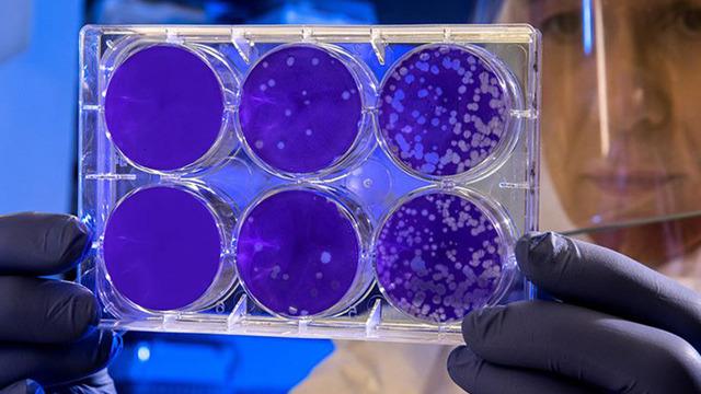 Ünlü aktörün eşini hayattan koparmıştı: O virüs 3 can daha aldı! Hava yoluyla bulaşabiliyor