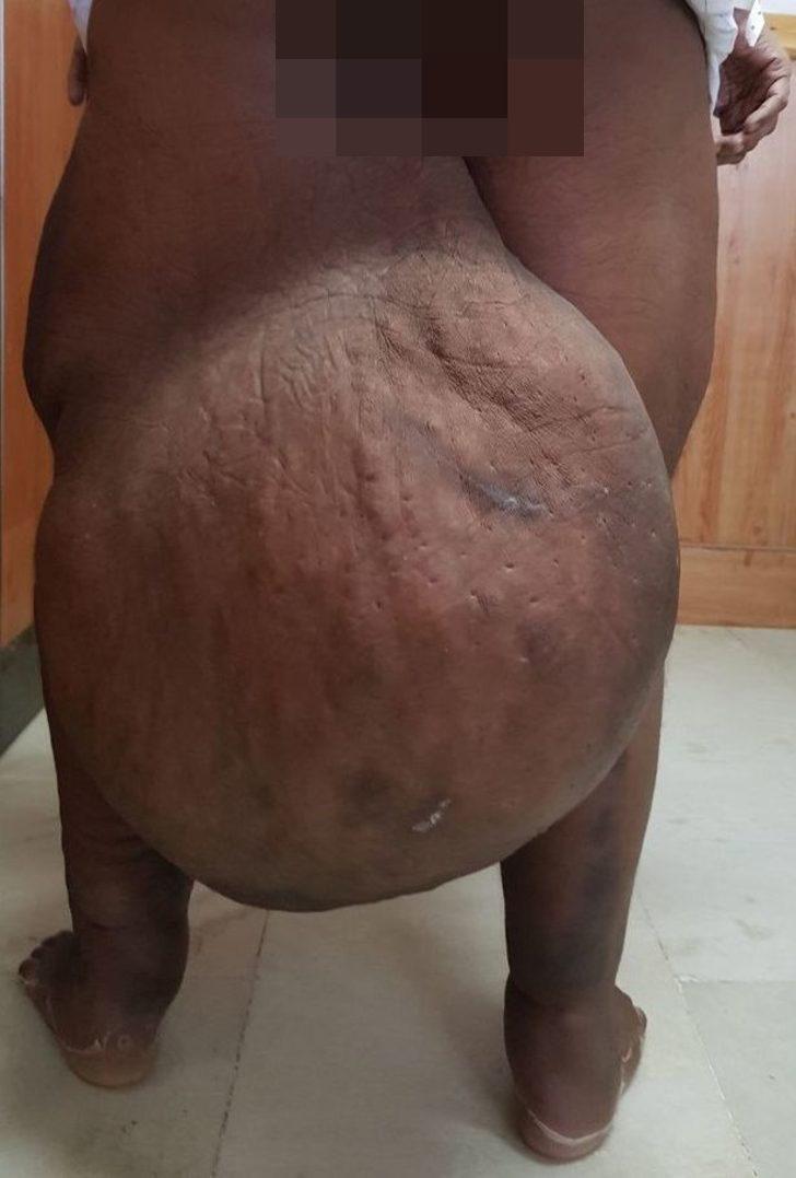 Onu bu hale sivrisinek ısırığı getirdi! G2