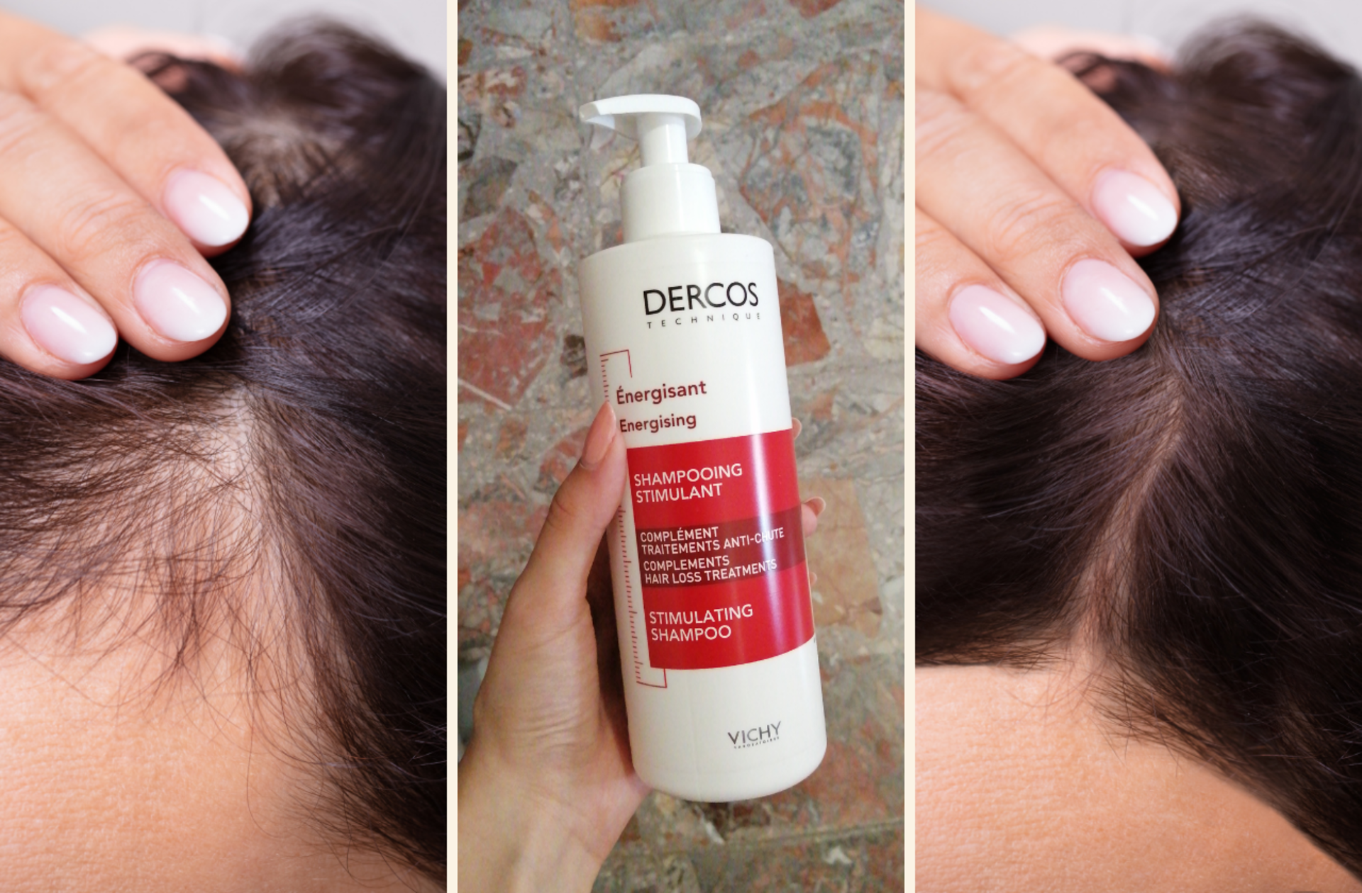 Saç dökülmesine elveda! Saçlarınızda dönüşüm başlatacak en etkili ürünler