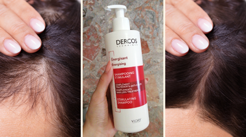 Sa&ccedil; d&ouml;k&uuml;lmesine elveda demenizi sağlayacak en etkili &uuml;r&uuml;nler