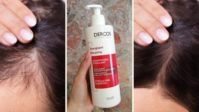 Saç dökülmesine elveda! Saçlarınızda dönüşüm başlatacak en etkili ürünler