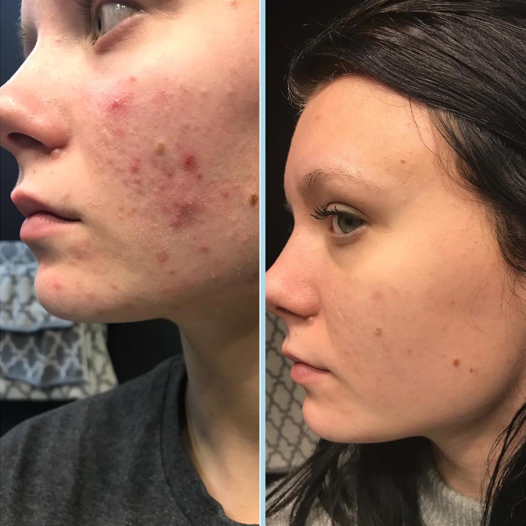 Deneyince "Gerçekten bu kadar etkili miymiş?" diyeceğiniz güzellik ürünleri 1