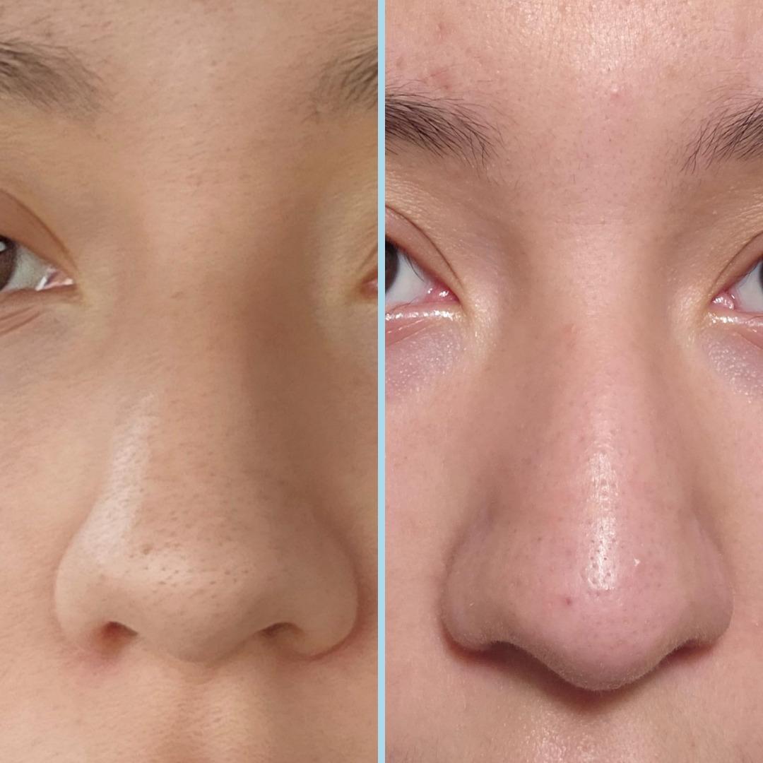 Deneyince "Gerçekten bu kadar etkili miymiş?" diyeceğiniz güzellik ürünleri 3