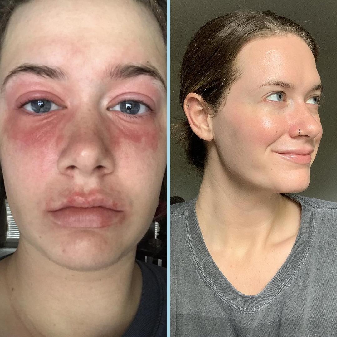 Deneyince "Gerçekten bu kadar etkili miymiş?" diyeceğiniz güzellik ürünleri 7