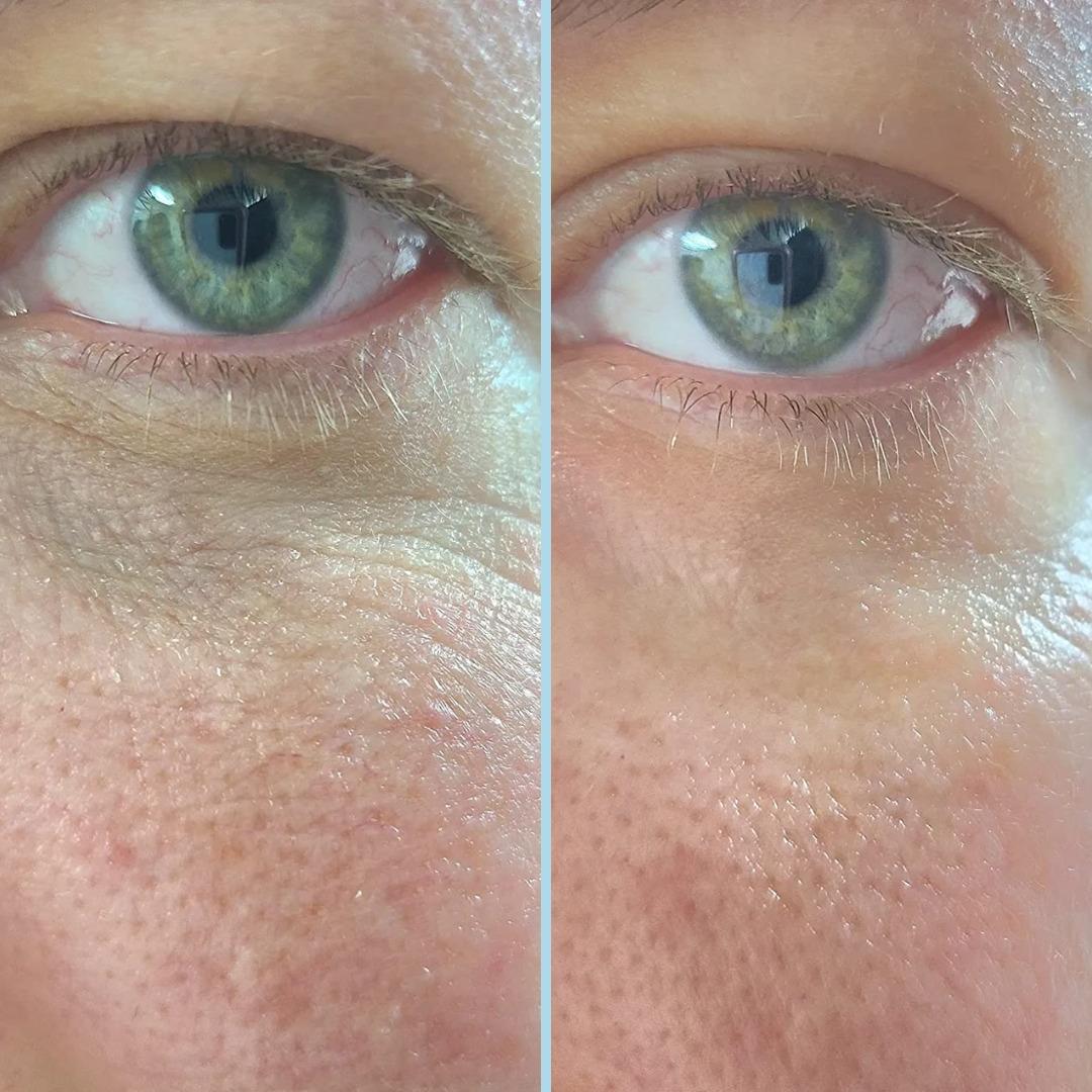 Deneyince "Gerçekten bu kadar etkili miymiş?" diyeceğiniz güzellik ürünleri 9