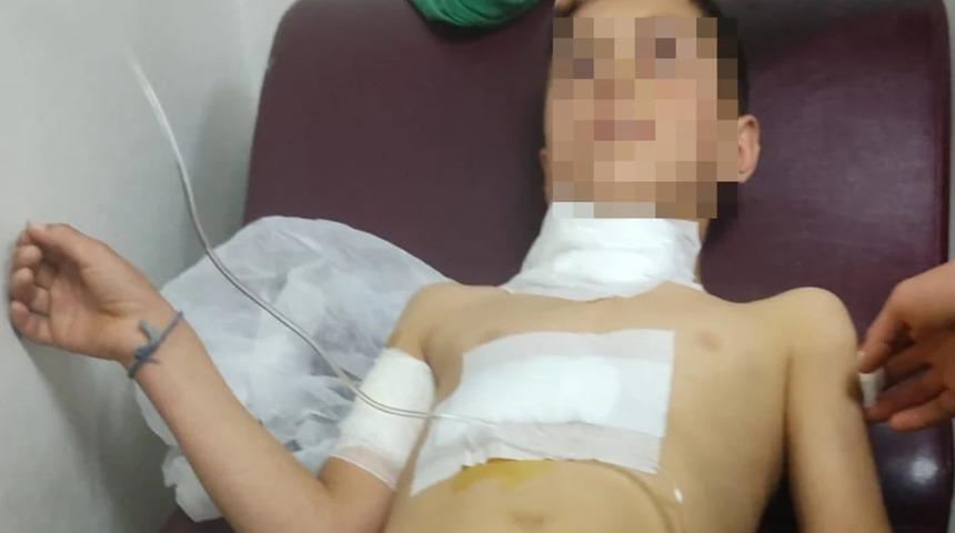 Sokakta oyun oynarken dehşeti yaşadı... 10 yaşındaki çocuğa köpek saldırdı