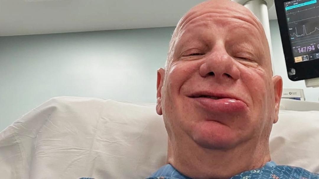 Ünlü komedyen Jeff Ross dondurma yedikten sonra hastanelik oldu! Yüzünün son halini paylaştı 2